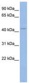 Potassium Voltage-Gated Channel Subfamily J Member 5 antibody, TA338512, Origene, Western Blot image 