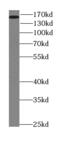 Rho Associated Coiled-Coil Containing Protein Kinase 2 antibody, FNab07379, FineTest, Western Blot image 
