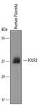 Folate Receptor Beta antibody, PA5-47764, Invitrogen Antibodies, Western Blot image 