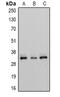 3,2-trans-enoyl-CoA isomerase, mitochondrial antibody, abx133545, Abbexa, Western Blot image 