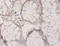 HPD antibody, LS-C285530, Lifespan Biosciences, Immunohistochemistry paraffin image 