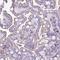 Cathepsin Z antibody, NBP2-38614, Novus Biologicals, Immunohistochemistry frozen image 