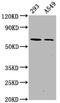 Protein Kinase AMP-Activated Catalytic Subunit Alpha 2 antibody, CSB-RA805325A491phHU, Cusabio, Western Blot image 