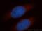 ATP/GTP Binding Protein Like 2 antibody, 13325-1-AP, Proteintech Group, Immunofluorescence image 