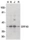 DNA Fragmentation Factor Subunit Beta antibody, PA5-19913, Invitrogen Antibodies, Western Blot image 