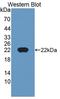 Cyclin Dependent Kinase Inhibitor 2D antibody, LS-C663481, Lifespan Biosciences, Western Blot image 