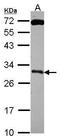 Kallikrein Related Peptidase 10 antibody, GTX114670, GeneTex, Western Blot image 
