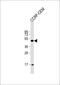 n-myc antibody, 62-879, ProSci, Western Blot image 