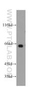Myocyte Enhancer Factor 2C antibody, 20326-1-AP, Proteintech Group, Western Blot image 
