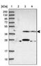 Zinc Finger Protein 671 antibody, PA5-61149, Invitrogen Antibodies, Western Blot image 