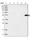 Fibroblast Growth Factor Receptor Substrate 3 antibody, NBP1-83421, Novus Biologicals, Western Blot image 