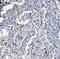Autophagy Related 7 antibody, A00346, Boster Biological Technology, Immunohistochemistry paraffin image 