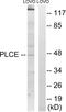 1-Acylglycerol-3-Phosphate O-Acyltransferase 5 antibody, abx014066, Abbexa, Western Blot image 