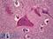 CaM Kinase Like Vesicle Associated antibody, LS-B6648, Lifespan Biosciences, Immunohistochemistry paraffin image 