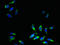 Solute Carrier Family 31 Member 2 antibody, orb25712, Biorbyt, Immunofluorescence image 