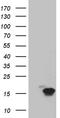Trefoil Factor 1 antibody, TA804522S, Origene, Western Blot image 