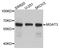 Mannosyl (Beta-1,4-)-Glycoprotein Beta-1,4-N-Acetylglucosaminyltransferase antibody, A8134, ABclonal Technology, Western Blot image 