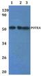 POTE ankyrin domain family member A antibody, PA5-75900, Invitrogen Antibodies, Western Blot image 