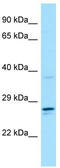 Colony Stimulating Factor 2 Receptor Alpha Subunit antibody, TA338295, Origene, Western Blot image 