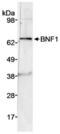 Chordin Like 2 antibody, NB100-2319, Novus Biologicals, Western Blot image 