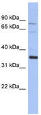 Nuclear Receptor Binding Protein 2 antibody, TA344187, Origene, Western Blot image 