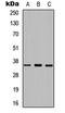 Serine Protease 8 antibody, LS-C354469, Lifespan Biosciences, Western Blot image 