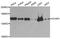Cell Division Cycle And Apoptosis Regulator 1 antibody, A6334, ABclonal Technology, Western Blot image 
