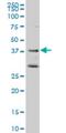 DnaJ Heat Shock Protein Family (Hsp40) Member B2 antibody, H00003300-M02, Novus Biologicals, Western Blot image 