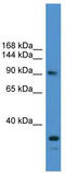 Ubiquitin carboxyl-terminal hydrolase 13 antibody, TA342567, Origene, Western Blot image 