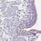 Armadillo Repeat Containing 4 antibody, NBP1-84175, Novus Biologicals, Immunohistochemistry frozen image 