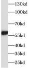 Aldehyde Dehydrogenase 6 Family Member A1 antibody, FNab00298, FineTest, Western Blot image 