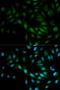 Mitogen-Activated Protein Kinase 7 antibody, LS-C331904, Lifespan Biosciences, Immunofluorescence image 