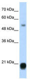Chromobox 3 antibody, TA338045, Origene, Western Blot image 