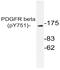 Platelet Derived Growth Factor Receptor Beta antibody, AP20900PU-N, Origene, Western Blot image 