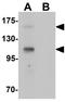 RUN And SH3 Domain Containing 2 antibody, GTX32050, GeneTex, Western Blot image 
