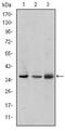 LIM and senescent cell antigen-like-containing domain protein 1 antibody, MA5-15876, Invitrogen Antibodies, Western Blot image 
