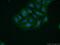 Catenin alpha-2 antibody, 14362-1-AP, Proteintech Group, Immunofluorescence image 