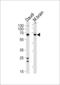 Protein Kinase C And Casein Kinase Substrate In Neurons 2 antibody, LS-C101183, Lifespan Biosciences, Western Blot image 