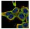 LYN Proto-Oncogene, Src Family Tyrosine Kinase antibody, NBP2-17189, Novus Biologicals, Immunocytochemistry image 