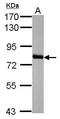 HAL antibody, GTX110371, GeneTex, Western Blot image 