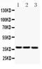 CD79b Molecule antibody, PB9169, Boster Biological Technology, Western Blot image 