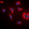 Microtubule Affinity Regulating Kinase 1 antibody, LS-C368605, Lifespan Biosciences, Immunofluorescence image 