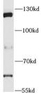Poly(ADP-Ribose) Polymerase 1 antibody, FNab06151, FineTest, Western Blot image 