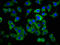 Adenylate Cyclase 8 antibody, LS-C669677, Lifespan Biosciences, Immunofluorescence image 