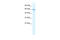 Cholinergic Receptor Nicotinic Alpha 7 Subunit antibody, ARP35418_T100, Aviva Systems Biology, Western Blot image 