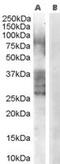 ADAM Metallopeptidase Domain 33 antibody, MBS420793, MyBioSource, Western Blot image 