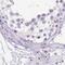 Endoplasmic Reticulum Protein 27 antibody, NBP2-38679, Novus Biologicals, Immunohistochemistry paraffin image 