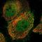Bardet-Biedl Syndrome 9 antibody, NBP1-88927, Novus Biologicals, Immunocytochemistry image 