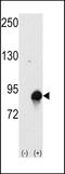 Cullin-4A antibody, LS-B11715, Lifespan Biosciences, Western Blot image 