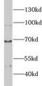 High molecular weight kininogen antibody, FNab10493, FineTest, Western Blot image 